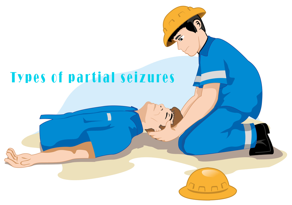 partial seizures