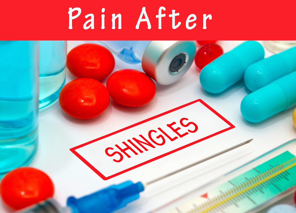 Pain after shingles